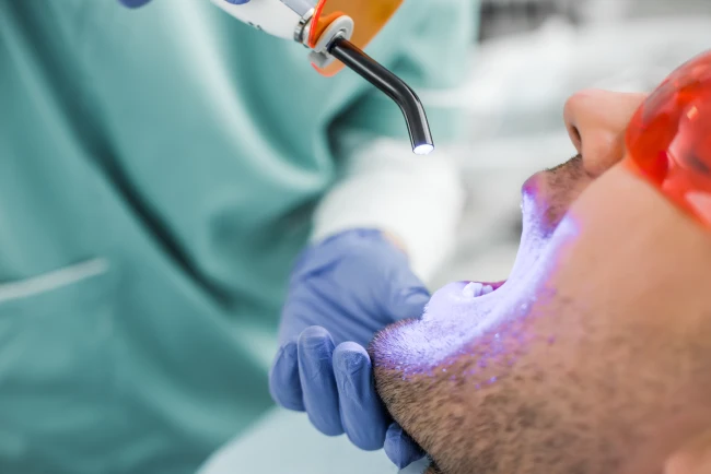 Laser Dentistry