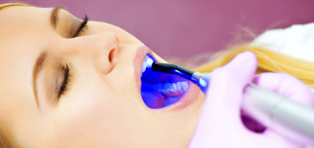 Benefits Of Metro Dental Etobicoke Laser Dentistry